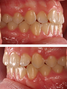 Intraorale Aufnahme der Zähne