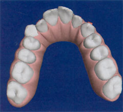 Invisalign ClinChek - Praxis Dr. Blens in Pulheim